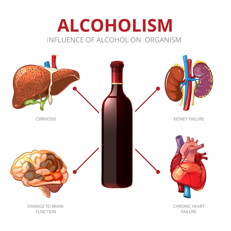 Free Vector long-term effects of alcohol. organism function and brain damage, failure kidney illustration. alcoholism vector infographic