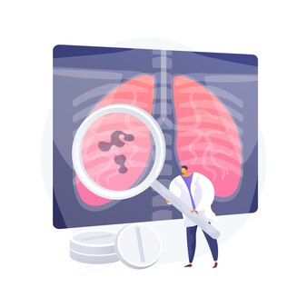 健康な人と喫煙者の肺と肺胞 臓器のイラスト 呼吸器の解剖学 科学と病気 ベクトル医療図 無料のベクター 健康な人と喫煙者の肺と肺胞 臓器のイラスト 呼吸器の解剖学 科学と病気 ベクトル医療図 無料のベクター