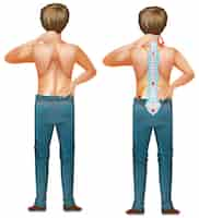 Free vector male human with back pain