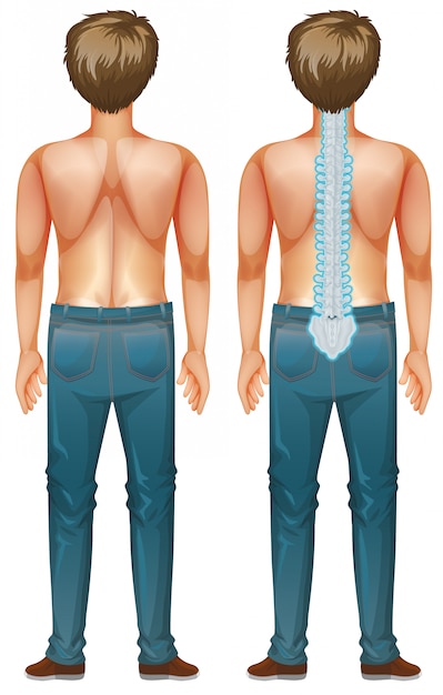 Free vector man showing spinal cord injury