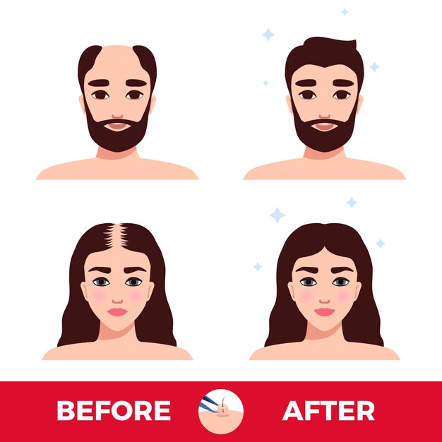 man and woman before and after hair transplantation on white