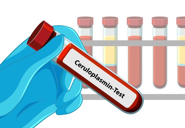Medical Blood Test Illustration