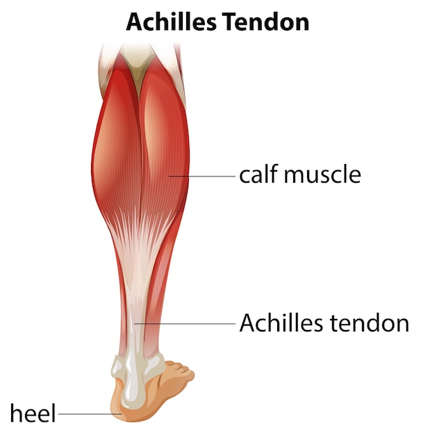 Vettore gratuito infografica medica del tendine di achille