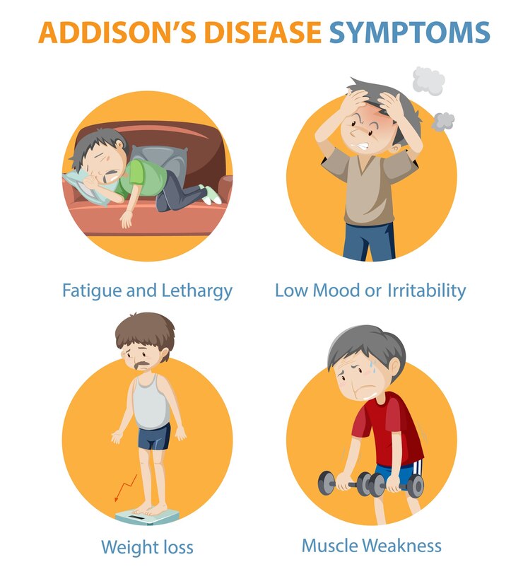 무료 Vector addison의 질병 증상에 대한 의료 정보