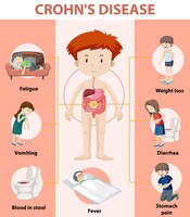 Medical infographic of crohn's disease
