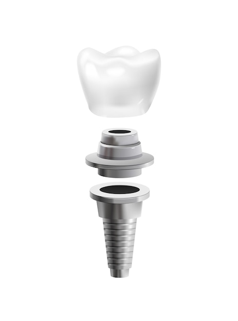 Металлический стоматологический пост реалистичная иконка изолированная векторная иллюстрация