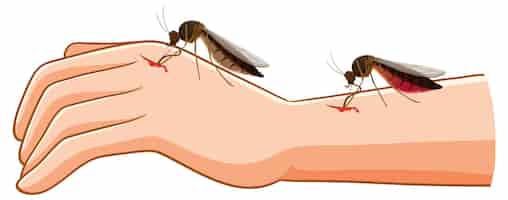 Free vector mosquito bite and blood extraction from human arm