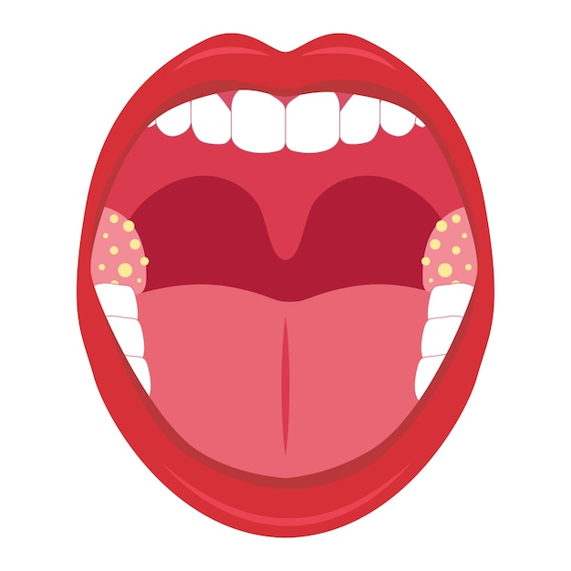 Premium Vector | Mouth cancer vector art illustration