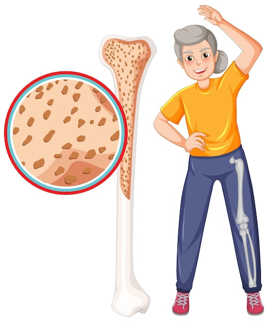 Free vector osteoporosis in old people