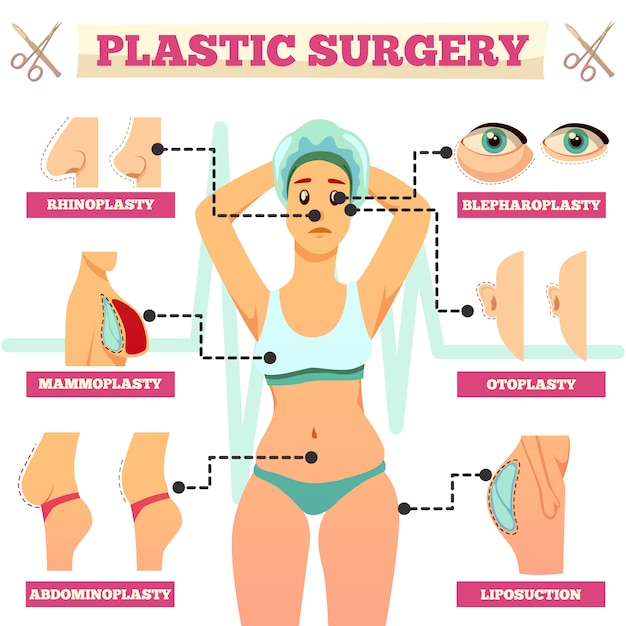 Diagramma di flusso ortogonale per chirurgia plastica