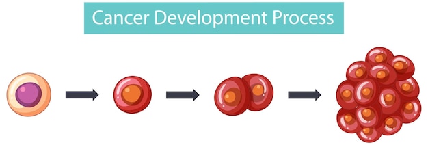 Infografica sul processo di sviluppo del cancro