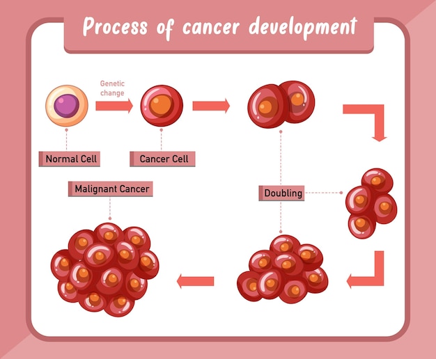 Infografica sul processo di sviluppo del cancro