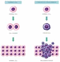 無料ベクター がん細胞の発達過程