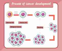 Бесплатное векторное изображение Инфографика процесса развития рака
