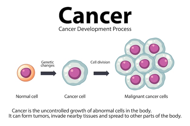 Free vector processing of cancer cells an infographic exploration