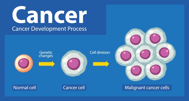 무료 벡터 암 세포 의 처리 - 인포그래픽 탐구