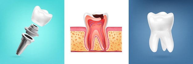 Реалистичный дизайн с иллюстрацией анатомии человеческого зуба