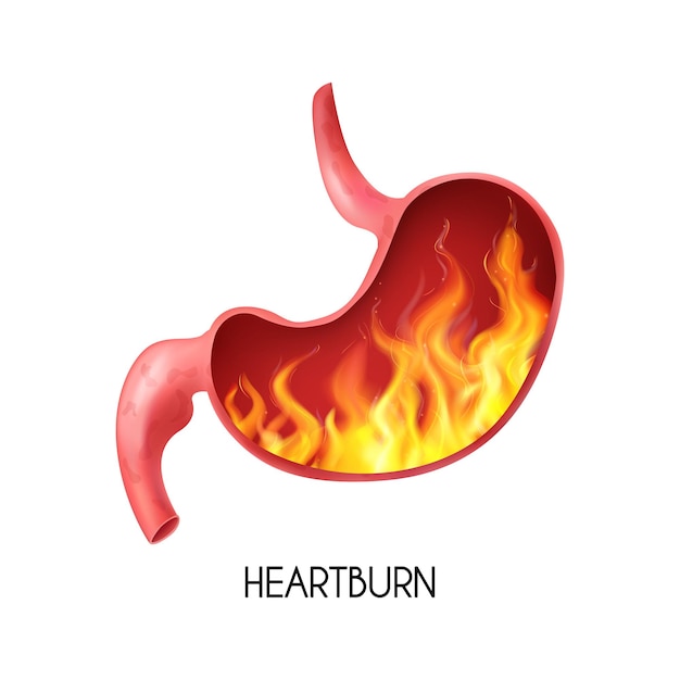 白い背景のベクトル図に胸焼けと現実的な人間の内臓胃