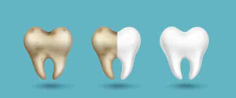 Бесплатное векторное изображение Реалистичный зуб грязный серый и чистый белый