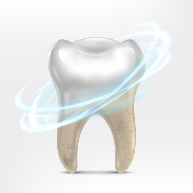 Illustrazione realistica dell'icona vettoriale concetto di sbiancamento dei denti clinica dentale dente bianco e sporco