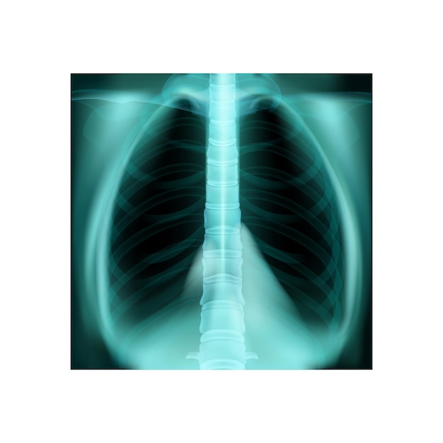 Free vector realistic world pneumonia day composition with isolated illustration of xray shot of human lungs