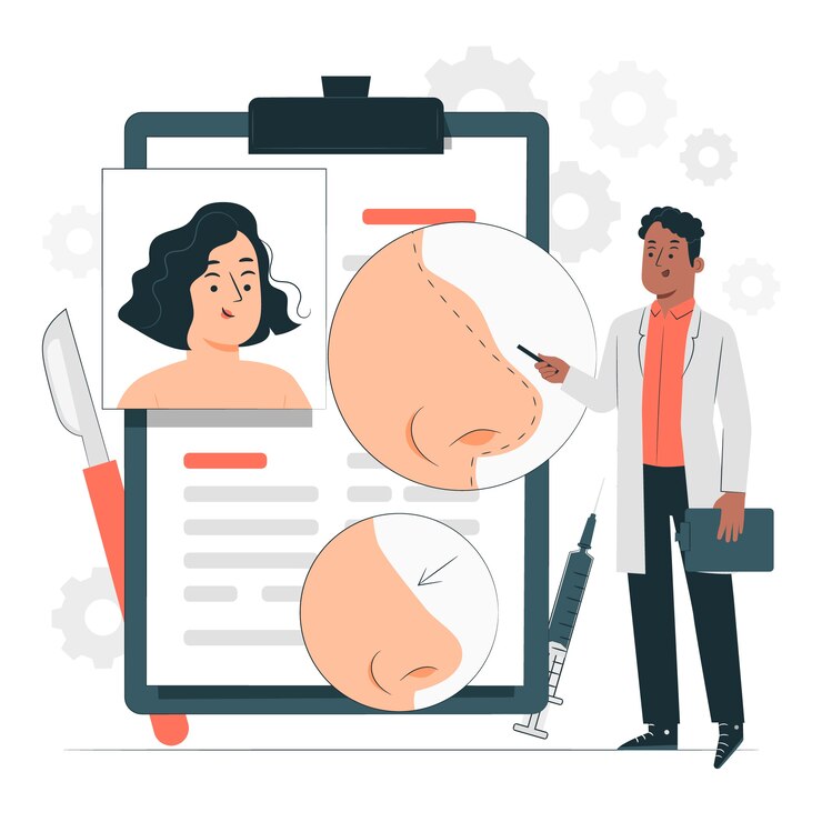 Free Vector rhinoplasty concept illustration