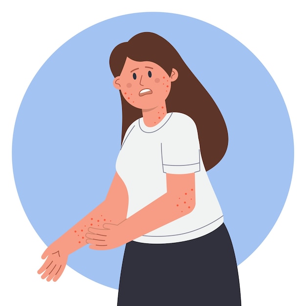 湿疹の症状を持つ悲しい女性の漫画のキャラクター。かゆみのある手や皮膚病に苦しんでいる女性フラットベクトルイラスト。バナーやウェブサイトのデザインのためのアレルギー、皮膚科の概念