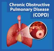 Free vector science education of human anatomy copd infographic