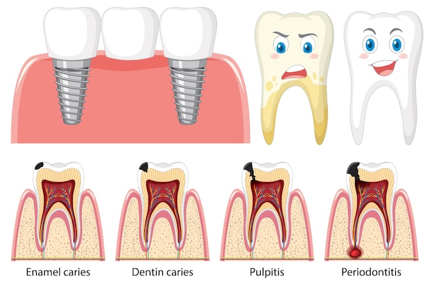 Set of all types of teeth on white background