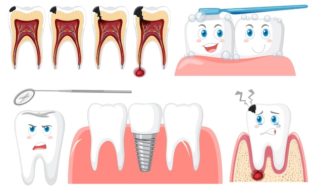 Set di tutti i tipi di denti su sfondo bianco