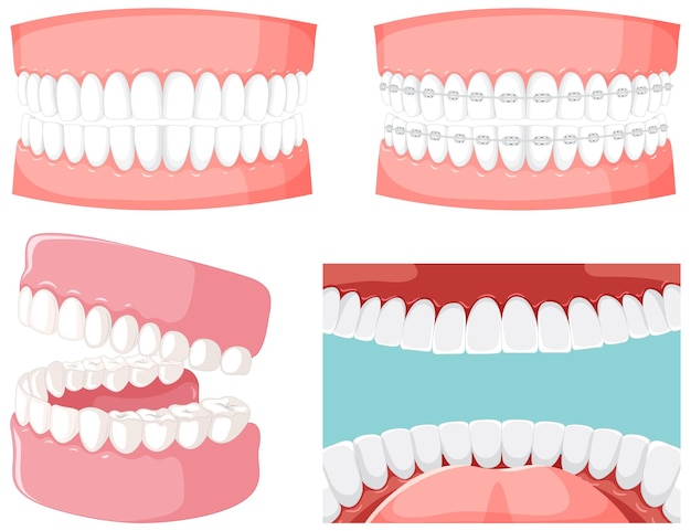 無料ベクター 人間の歯のモデルで人間の口の中の歯のセット