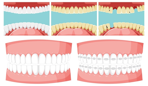 Vettore gratuito insieme dei denti all'interno della bocca umana con il modello dei denti umani
