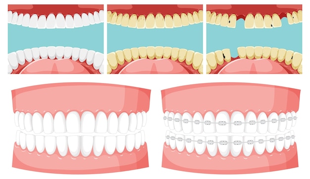 Set of teeth inside human mouth with human teeth model