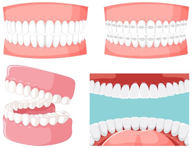 人間の歯のモデルで人間の口の中の歯のセット