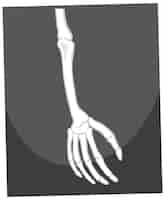 Free vector skeleton of arm and hand