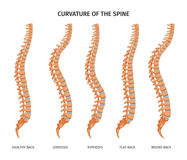 Free vector spine structure anatomy set of isolated images with healthy back lordosis kyphosis flat and round backs vector illustration