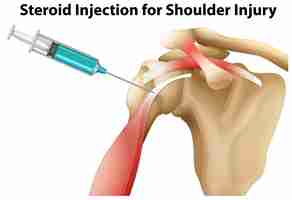 Free vector steroid injection for shoulder injury