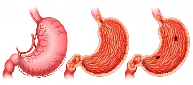 Stomach infographic