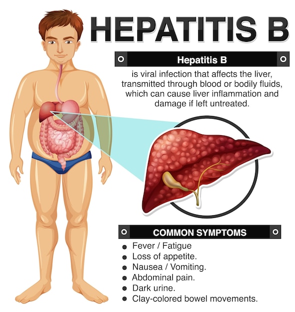 Symptoms of hepatitis b infographic