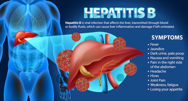 Symptoms of hepatitis b infographic