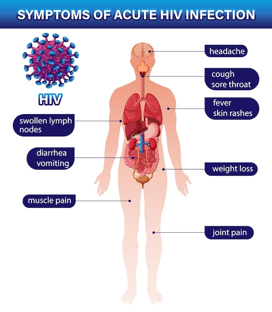 급성 hiv 감염의 증상