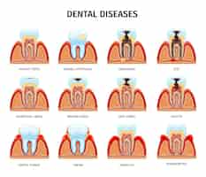 Free vector teeth anatomy problems set with isolated compositions of tooth in jaw healthy and damaged with text vector illustration
