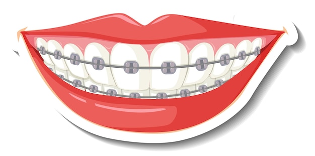 Free vector teeth with braces on white background