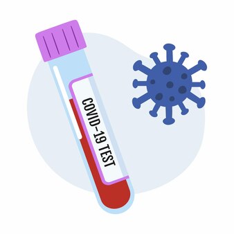 Covid​-​19​コロナ​ウイルス​に対する​抗体​について​血液​を​検査する​ため​の​試験管​。​実験室​試験用​の​サンプル​。