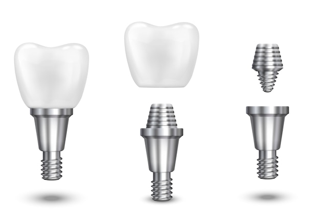 Free vector tooth implant. implant dental and health tooth, healthy implant, vector illustration