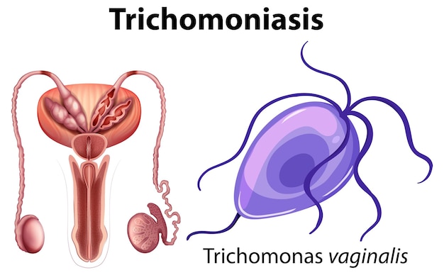 무료 벡터 흰색 배경에 trichomonas vaginalis