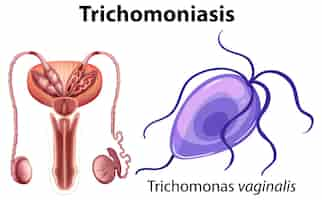 Vettore gratuito trichomonas vaginalis su sfondo bianco