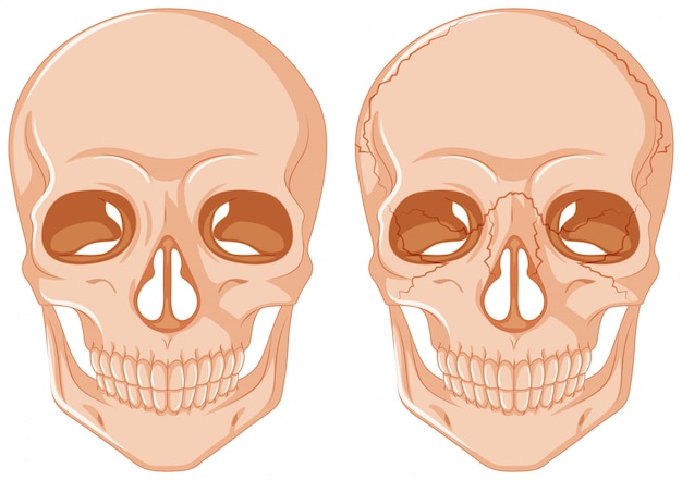 無料ベクター 白い背景の上の2つの頭蓋骨