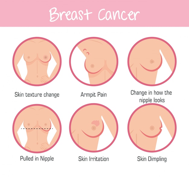 Types of appearances of the breast