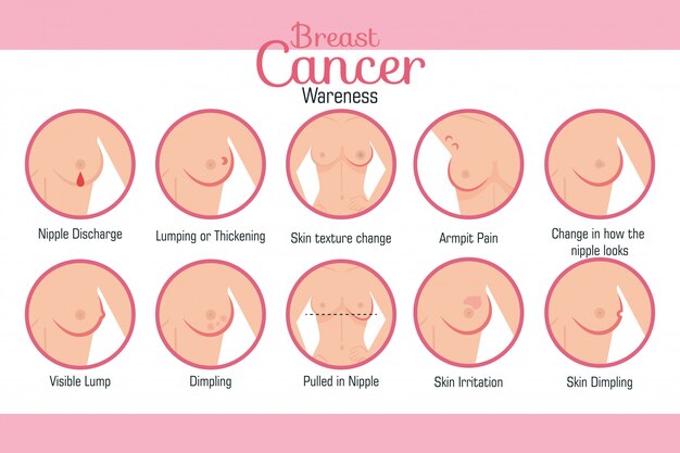 乳房の外観の種類